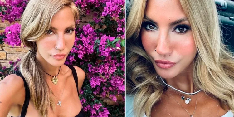 Çağla Şıkel bacak morlukları sosyal medyada gündem oldu